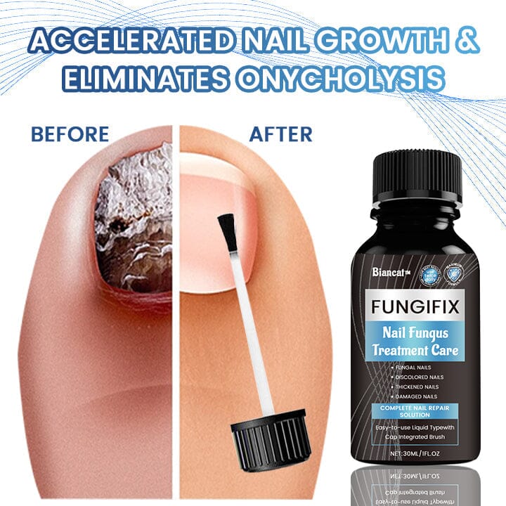 Biancat™ FungiFix Nail Fungus Treatment Care Fluid