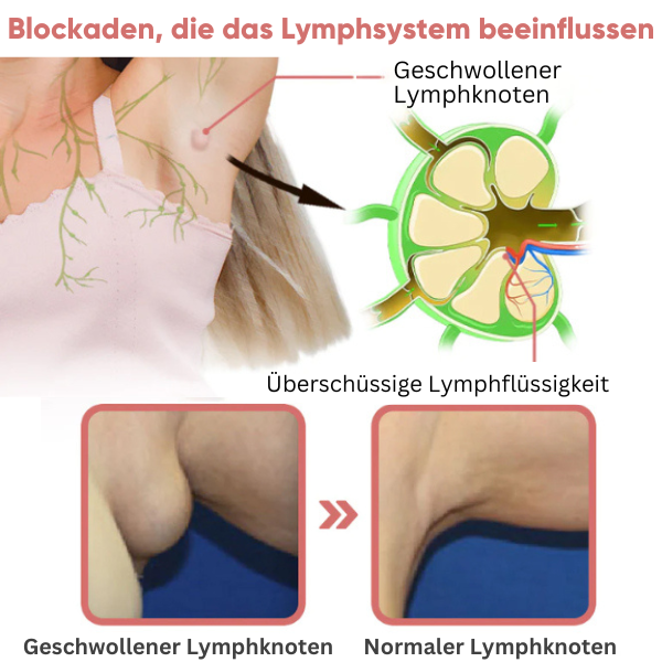 LymphFlow™ Magnetogen