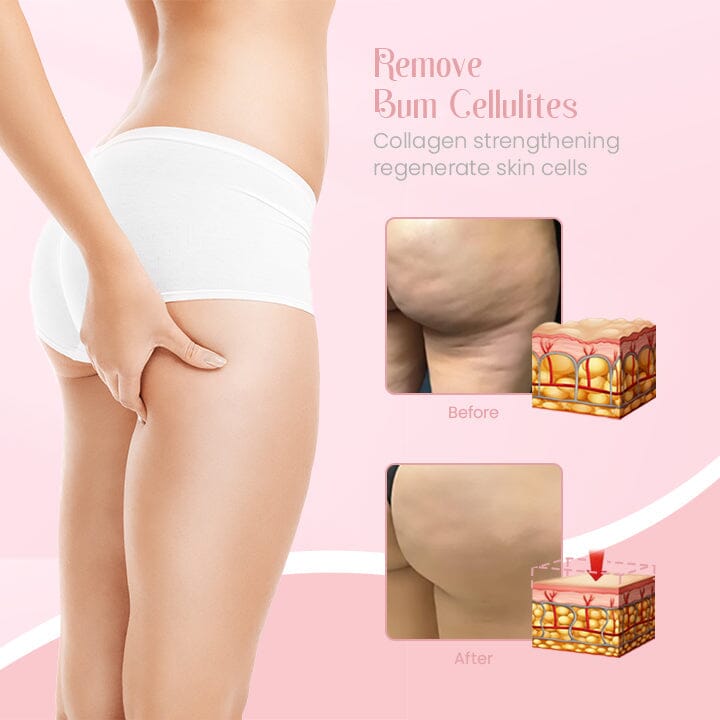 Ceoerty™ PeachPerk Butt Lifting Cream
